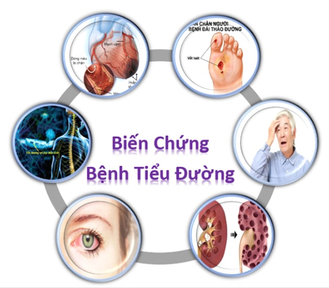 Biến chứng mạn tính tiểu đường 