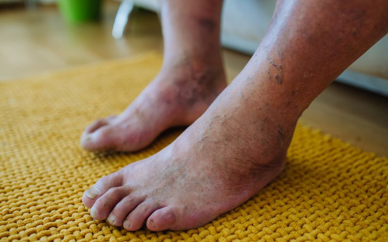 bệnh tiểu đường là gì