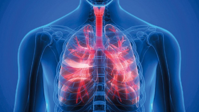 Biến chứng COPD