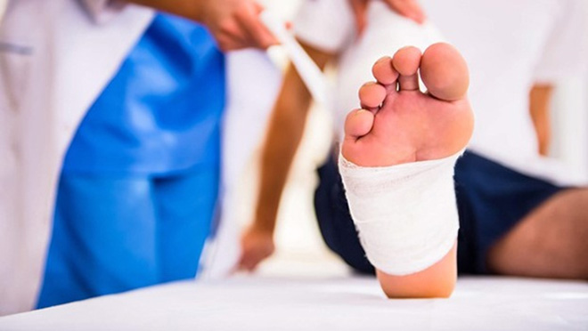 Biến chứng bàn chân tiểu đường: Nguyên nhân, dấu hiệu, phòng ngừa và xử trí