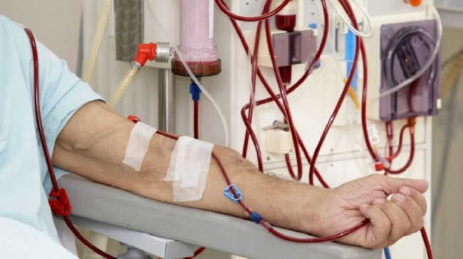 Chạy thận nhân tạo 