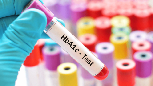 Cách đọc kết quả: Chỉ số HbA1c bao nhiêu là bị tiểu đường?