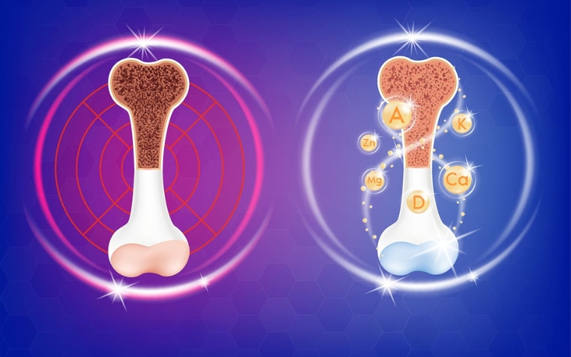 sữa loãng xương cho người lớn tuổi