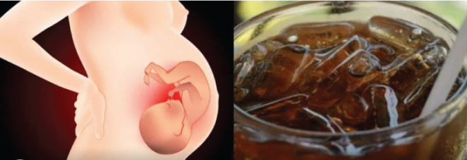 Đồ uống có gas không tốt cho người bệnh tiểu đường