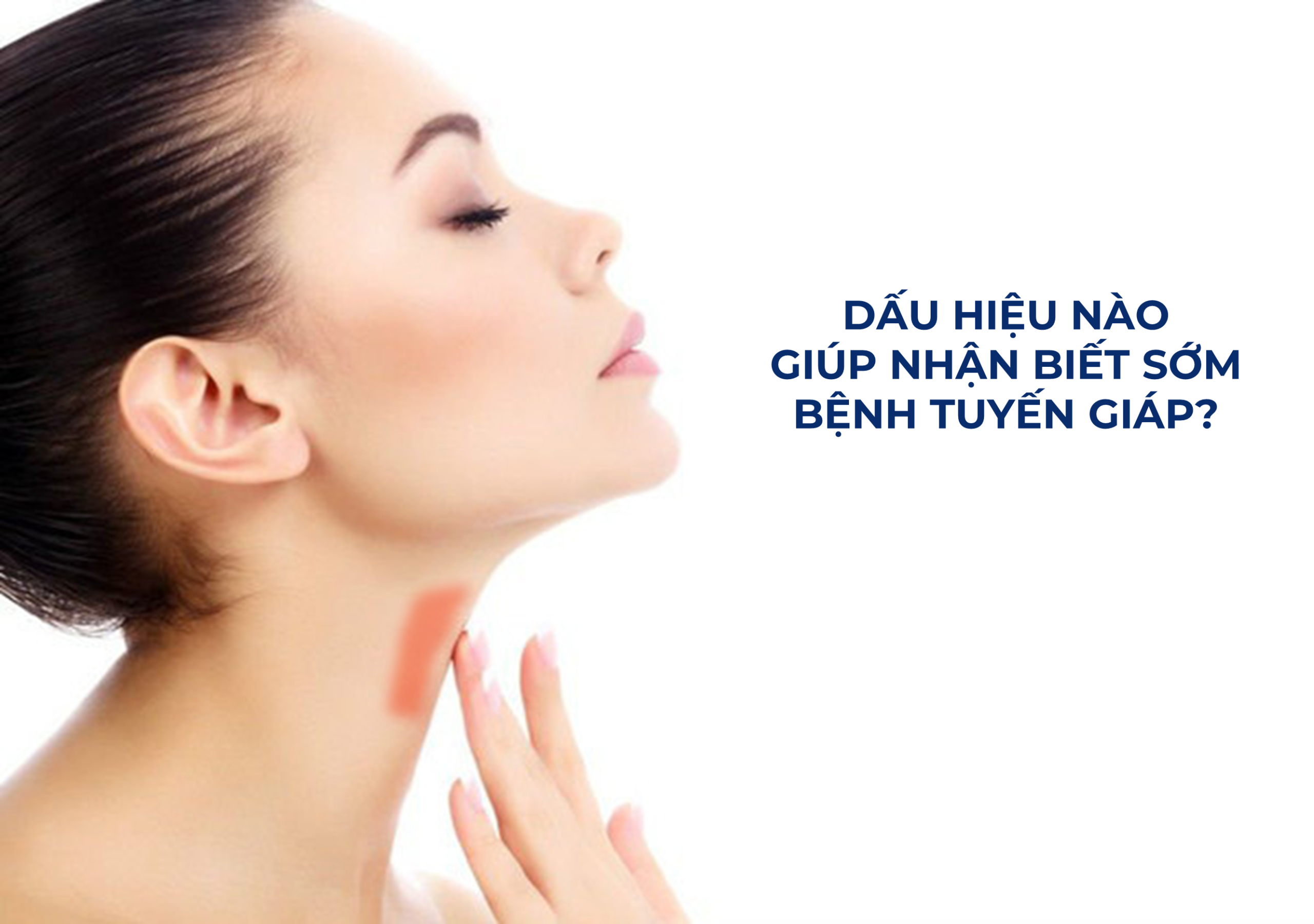 6 dấu hiệu giúp tầm soát sớm bệnh tuyến giáp