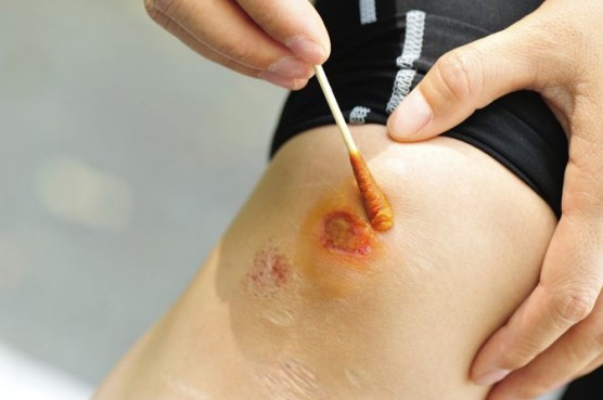 18-556x369-1 Những biểu hiện của thiếu vitamin D ở phụ nữ.