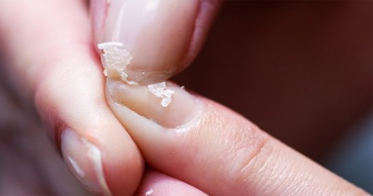 Cơ Thể Đang Thiếu Canxi Nếu Có Những Biểu Hiện Này