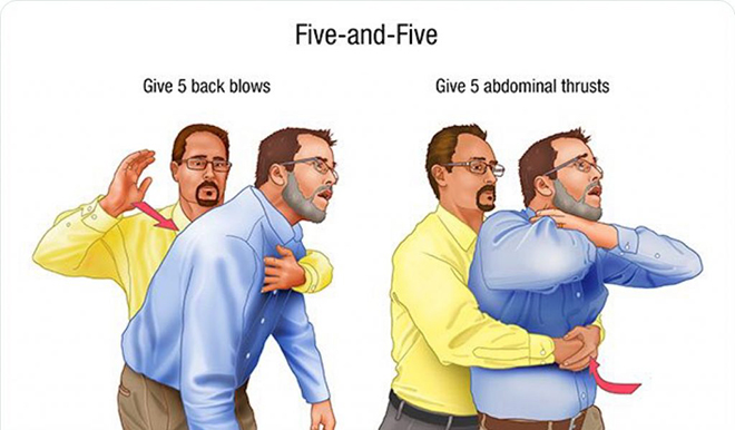 Khai thông đường thở