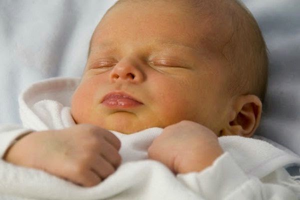 newborn-jaundice width=