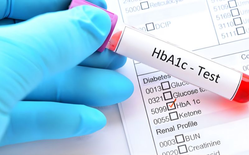 chỉ số tiểu đường